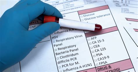 what impacts get blood test|how to check blood test results.